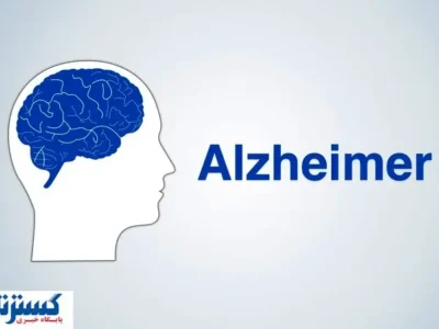 با آزمایش ۳ دقیقه ای آلزایمر را در نطفه خفه کنید !