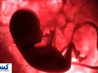 دولت شرایط سقط جنین قانونی را اعلام کرد | کدام روش بهتر است د؟