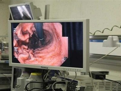 بیماری‌های گوارشی در کودکان