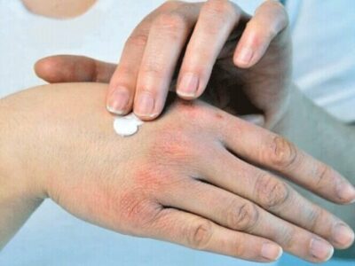 راهکارهای طب ایرانی برای حفظ سلامت پوست و بدن در فصل سرد