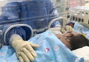 آب حاوی فلوراید، بر وزن هنگام تولد تأثیری ندارد