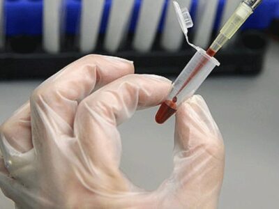 اینجا سلامت خون حرف اول را می زند