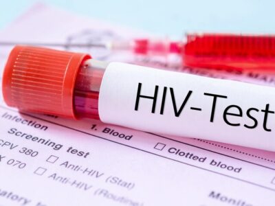 مهم‌ترین چالش امروز HIV در ایران